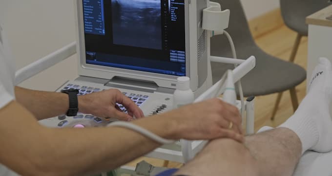 Ecografía musculoesquelética en iMov Fisioterapia